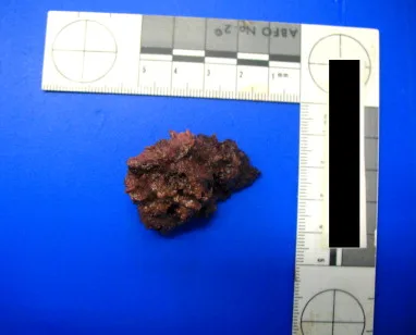 Kubur Digali Balik Lepas 383 Hari, Biskut Rungkai Punca Sebenar Kematian Nenek