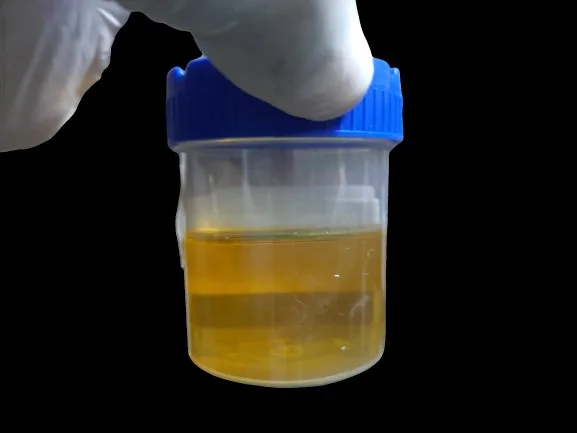 7 Pelajar Sekolah Alami Kencing Bernanah, ‘Tong Tong’ Duit Langgan Perempuan