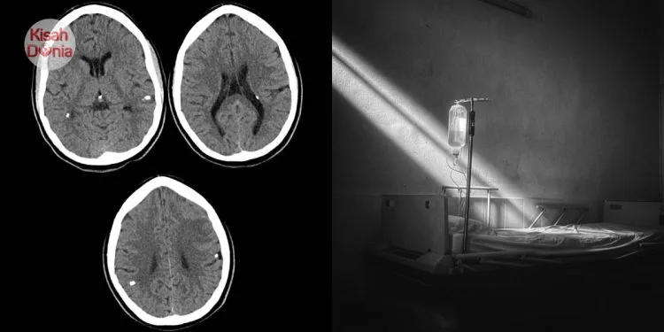 Nafkahi Anak Bini, Suami PJJ Rupanya Gigolo, Meninggal Akibat Bisul Otak & HIV