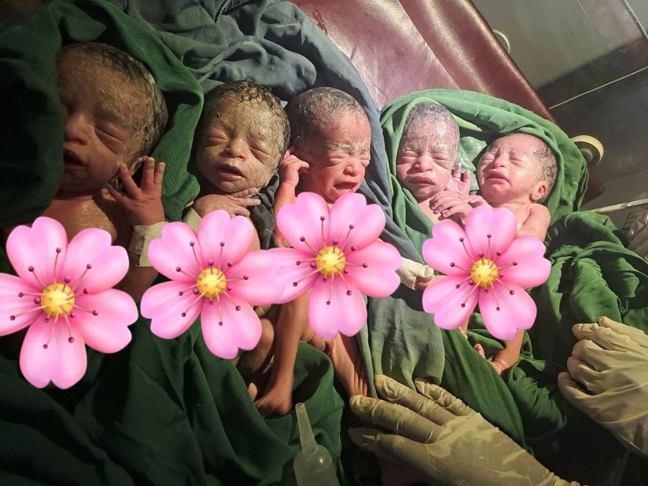 12 Tahun Tertekan Tunggu Zuriat, Wanita Kini Dikurniakan Kembar 5 Tanpa IVF