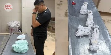 Muncul Kesan Lebam Lepas Akad Nikah, Wanita Disahkan Hipertensi Ditalak Suami