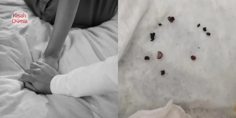 Bercinta Dengan 4 Lelaki & Buat Hubungan Bebas, Pelajar Dijangkiti Kutil Kelamin
