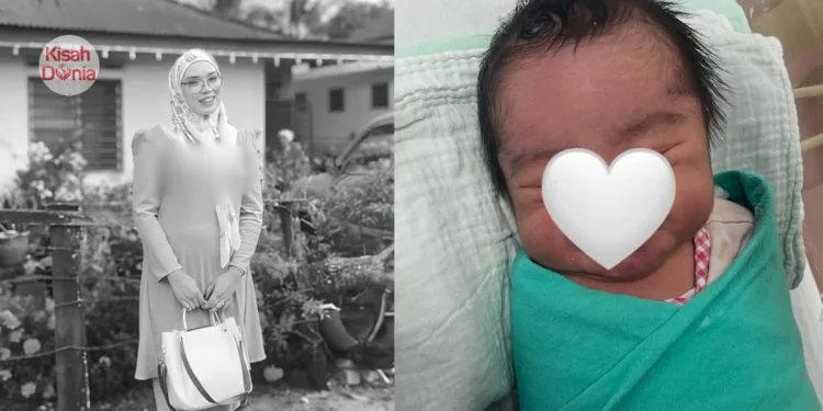 Pernah Mimpi Meninggal Dunia Sebelum Bersalin, Wanita Berpantang Dijemput Ilahi