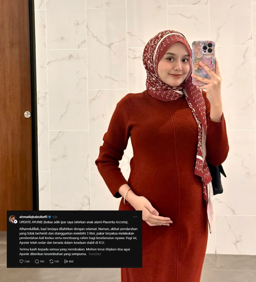 Kena Operate Kali Kedua Selepas Czer, Rahim Ayunie Terpaksa Dikeluarkan