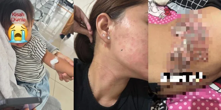 Suami Berbelas Kali Langgan Perempuan, Isteri & Anak Tanggung Jangkitan Kelamin
