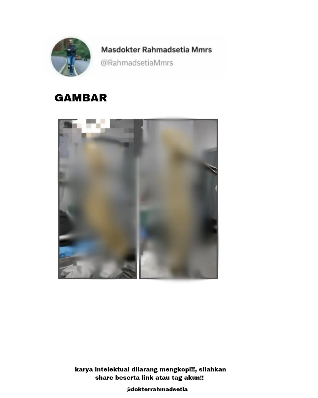Bau Busuk Saat Bersama, Rupanya ‘Sarung Plastik’ Tercicir 2 Minggu Dalam Isteri