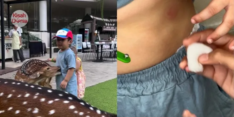 “Katanya Kids Friendly”-Ibu Terkejut Anak Tiba-Tiba Digigit Ketika Usap Rusa