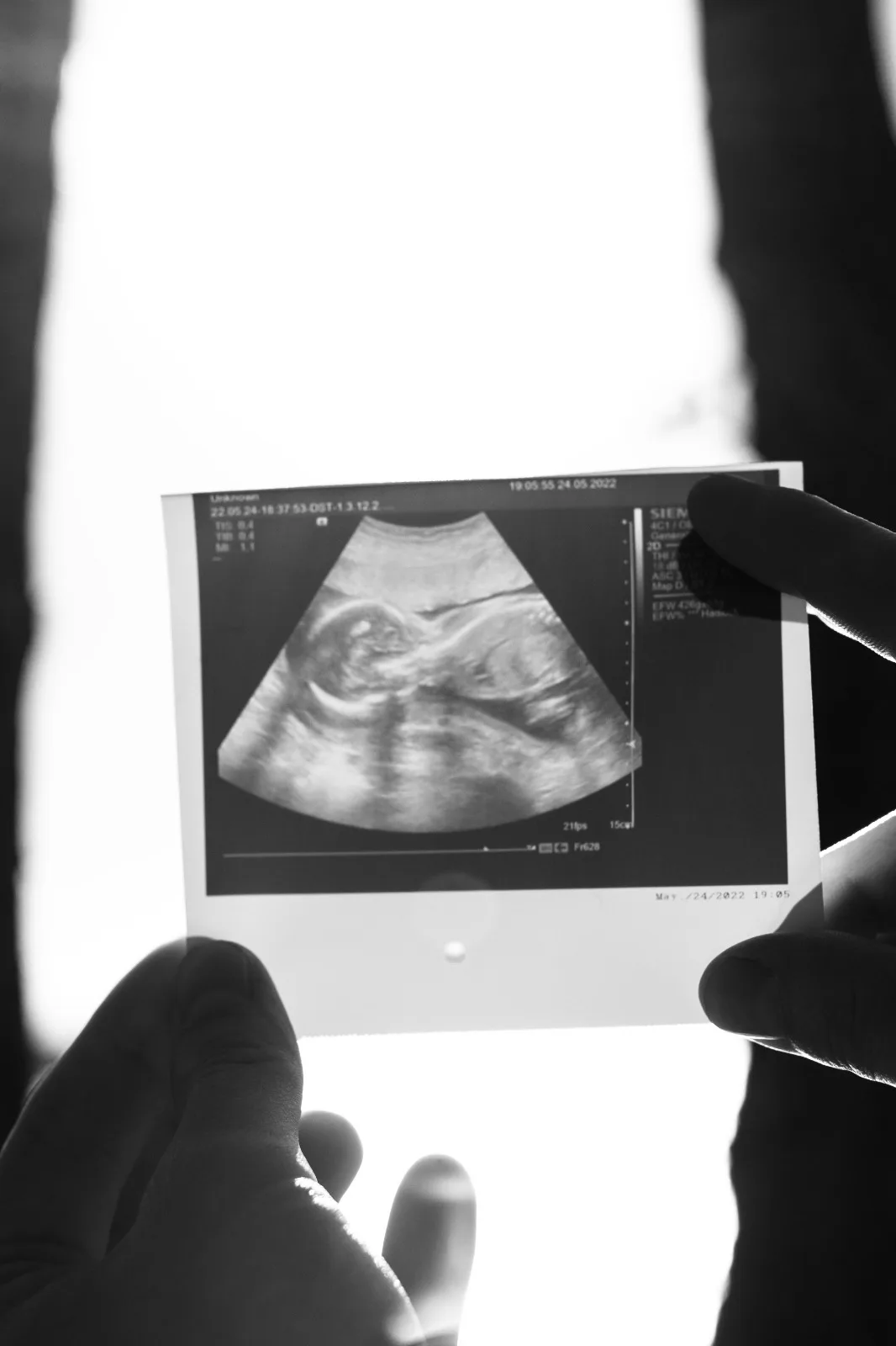 Suami Enggan Anak, Isteri Gugurkan Bayi 2X, Kemudian Bercerai Demi Wanita Lain