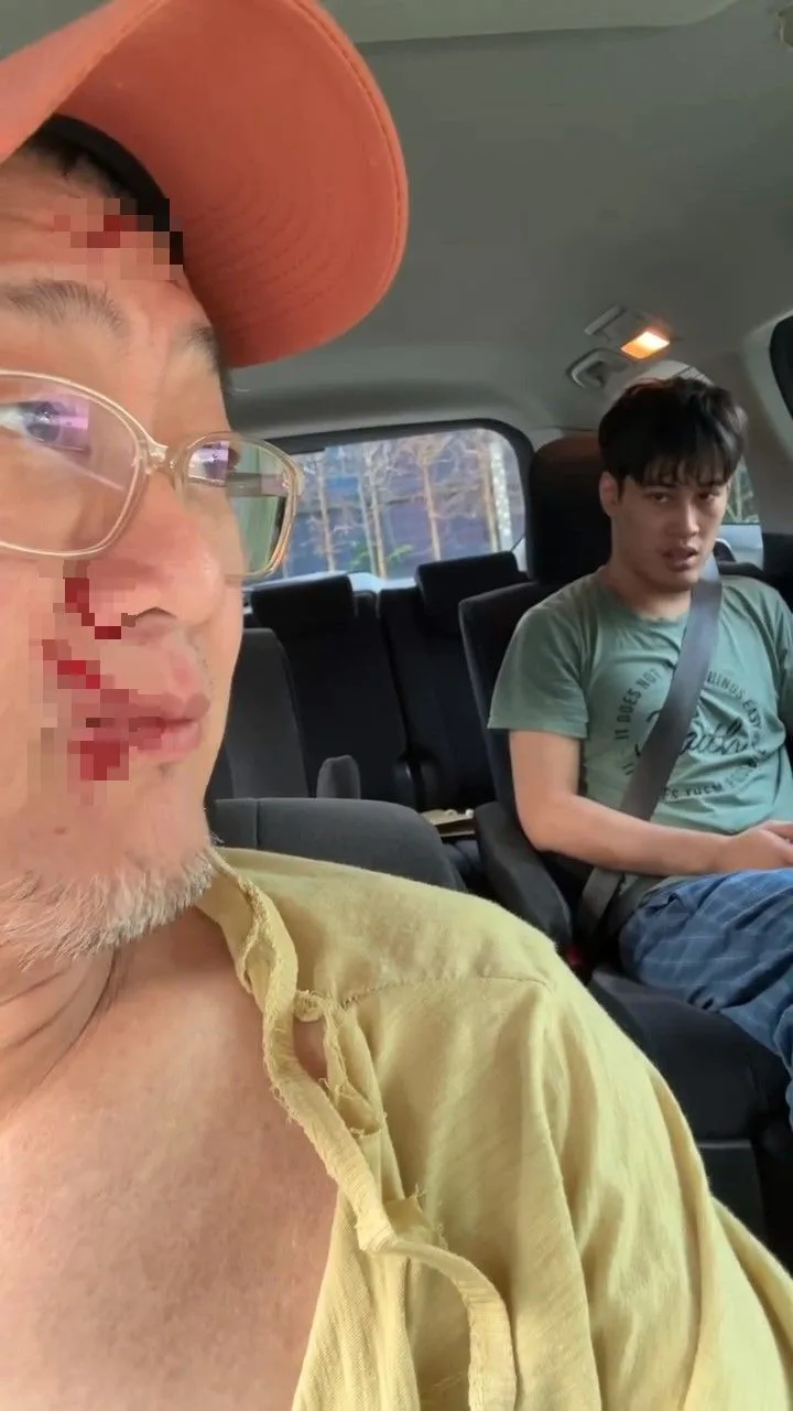 Bapa Bergelut Atas Jalan Untuk Tenangkan Adam, Orang Awam Hanya Lihat Tak Bantu